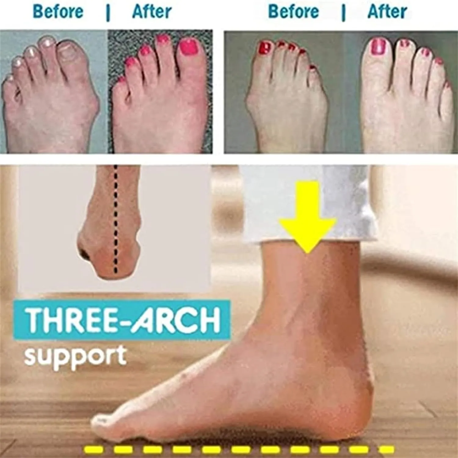 Comfortable Orthopedic Sandals, Women Fashion Retro Woven Slip-On Bunion Correction Sandals, Flat Heel Summer Casual Beach Shoes, for Big Toe Bone Correction Toe Arch Support