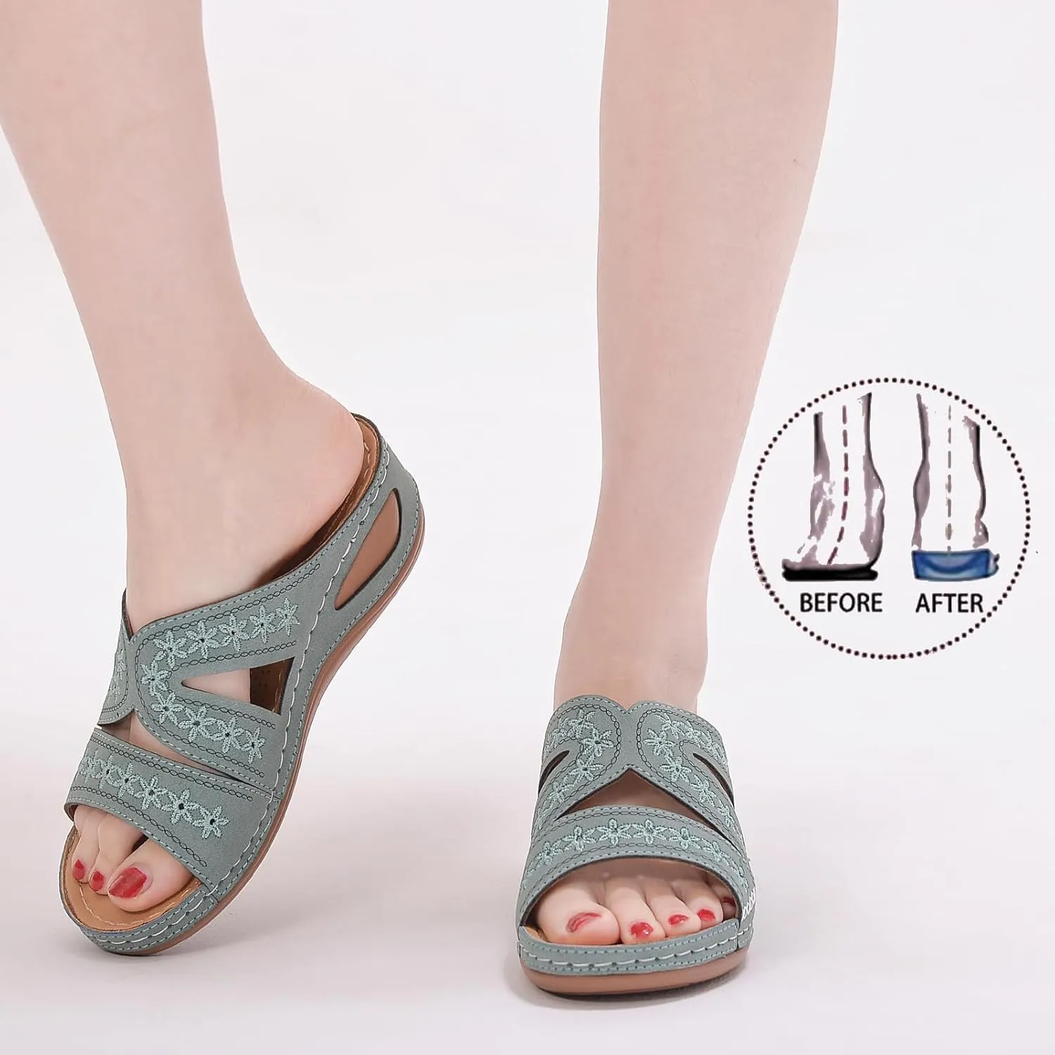 Women's Orthopedic Arch Support Wedge Sandals Summer Dressy 2025 Flat Open Toe Casual Flip Flops Platform Sandal Beach Sandals Dress Shoes Slip on Open Toe Sandal 2025